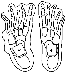 Krantz's skeletal reconstruction of the tracks